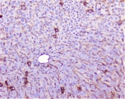 IHC staining of FFPE mouse liver with TNF Receptor antibody at 1ug/ml. HIER: boil tissue sections in pH6, 10mM citrate buffer, for 10-20 min followed by cooling at RT for 20 min.