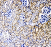 IHC staining of FFPE mouse liver with TNF Receptor antibody at 1ug/ml. HIER: boil tissue sections in pH6, 10mM citrate buffer, for 10-20 min followed by cooling at RT for 20 min.