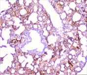 IHC staining of FFPE mouse lung with TNF Receptor antibody at 1ug/ml. HIER: boil tissue sections in pH6, 10mM citrate buffer, for 10-20 min followed by cooling at RT for 20 min.