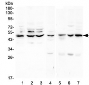 Western blot testing of 1) human HeLa, 2) human K562, 3) human Caco-2, 4) rat liver, 5) mouse small intestine, 6) mouse liver and 7) mouse HEPA1-6 lysate with TNF Receptor antibody at 0.5ug/ml. Predicted molecular weight ~51 kDa.