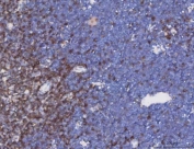 IHC staining of FFPE mouse thymus tissue with TRAC antibody. HIER: boil tissue sections in pH8 EDTA for 20 min and allow to cool before testing.