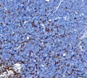 IHC staining of FFPE mouse thymus tissue with TRAC antibody. HIER: boil tissue sections in pH8 EDTA for 20 min and allow to cool before testing.