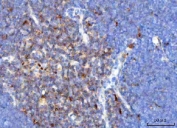 IHC staining of FFPE rat thymus tissue with TRAC antibody. HIER: boil tissue sections in pH8 EDTA for 20 min and allow to cool before testing.