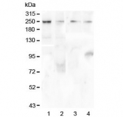 Western blot testing of human 1) HeLa, 2) COLO-320, 3) 22RV1 and 4) SGC-7901 lysate with TRPM7 antibody at 0.5ug/ml. Predicted molecular weight ~212 kDa.
