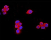 Immunofluorescent staining of FFPE human MCF7 cells with TRPM7 antibody (red) and DAPI nuclear stain (blue). HIER: steam section in pH6 citrate buffer for 20 min.