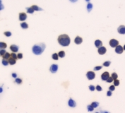 ICC staining of FFPE mouse LLC cells with TRX antibody at 1ug/ml. HIER: boil tissue sections in pH6, 10mM citrate buffer, for 10-20 min followed by cooling at RT for 20 min.