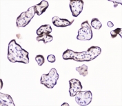 IHC staining of FFPE human placenta with UBC9 antibody at 1ug/ml. HIER: boil tissue sections in pH6, 10mM citrate buffer, for 10-20 min followed by cooling at RT for 20 min.