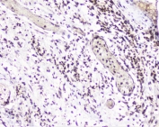 IHC staining of FFPE human appendicitis with UBC9 antibody at 1ug/ml. HIER: boil tissue sections in pH6, 10mM citrate buffer, for 10-20 min followed by cooling at RT for 20 min.