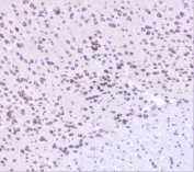 IHC staining of FFPE mouse brain with UBC9 antibody at 1ug/ml. HIER: boil tissue sections in pH6, 10mM citrate buffer, for 10-20 min followed by cooling at RT for 20 min.