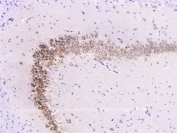 IHC staining of FFPE rat brain with UBC9 antibody at 1ug/ml. HIER: boil tissue sections in pH6, 10mM citrate buffer, for 10-20 min followed by cooling at RT for 20 min.