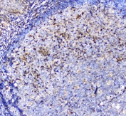 IHC staining of FFPE human tonsil with ADA antibody at 1ug/ml. HIER: boil tissue sections in pH6, 10mM citrate buffer, for 10-20 min followed by cooling at RT for 20 min.