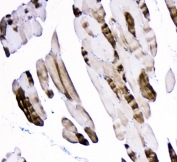 IHC staining of FFPE human skeletal muscle with ACTN3 antibody at 1ug/ml. HIER: boil tissue sections in pH6, 10mM citrate buffer, for 10-20 min followed by cooling at RT for 20 min.