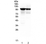 Western blot tesing of 1) rat skeletal muscle and 2) mouse skeletal muscle lysate with ACTN3 antibody at 0.5ug/ml. Predicted molecular weight ~103 kDa.