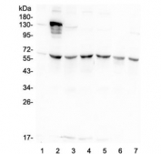 Western blot testing of human 1) A549, 2) 293T, 3) HeLa, 4) Caco-2, 5) K562, 6) HL60 and 7) PC-3 lysate with AKT2 antibody at 0.5ug/ml. Predicted molecular weight ~56 kDa.