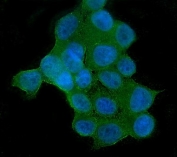 Immunofluorescent staining of FFPE human MCF7 cells with AKT2 antibody (green) and DAPI nuclear stain (blue). HIER: steam section in pH6 citrate buffer for 20 min.