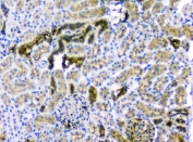 IHC staining of FFPE rat kidney with CD2AP antibody at 1ug/ml. HIER: boil tissue sections in pH6, 10mM citrate buffer, for 10-20 min followed by cooling at RT for 20 min.