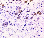 IHC staining of FFPE rat brain with CD2AP antibody at 1ug/ml. HIER: boil tissue sections in pH6, 10mM citrate buffer, for 10-20 min followed by cooling at RT for 20 min.