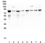 Western blot testing of human 1) K562, 2) A431, 3) 293T, 4) U-2 OS, 5) HL60, 6) MCF7, 7) HeLa and 8) PANC-1 lysate with CD2AP antibody at 0.5ug/ml. Predicted molecular weight: 71-80 kDa.