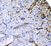 IHC staining of FFPE mouse kidney with CD2AP antibody at 1ug/ml. HIER: boil tissue sections in pH6, 10mM citrate buffer, for 10-20 min followed by cooling at RT for 20 min.