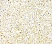 IHC staining of FFPE rat liver with FH antibody. HIER: boil tissue sections in pH8 EDTA for 20 min and allow to cool before testing.