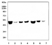 Western blot testing of 1) human K562, 2) human placenta, 3) monkey COS-7 and human 4) HL60, 5) Caco-2, 6) U-2 OS and 7) A549 cell lysate with FH antibody. Predicted molecular weight: ~55/50 kDa (isoforms 1/2).