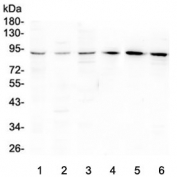 Western blot testing of rat 1) testis, 2) spleen, 3) brain and mouse 4) testis, 5) spleen and 6) brain lysate with Bcl6 antibody at 0.5ug/ml. Predicted molecular weight: 78~100 kDa.