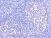 IHC staining of FFPE human tonsil tissue with Bcl6 antibody at 1ug/ml. HIER: boil tissue sections in pH6, 10mM citrate buffer, for 10-20 min followed by cooling at RT for 20 min.