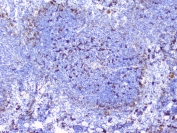 IHC staining of FFPE mouse spleen tissue with CD272 antibody at 1ug/ml. HIER: boil tissue sections in pH6, 10mM citrate buffer, for 10-20 min and allow to cool before testing.