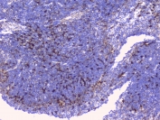 IHC staining of FFPE mouse spleen tissue with CD272 antibody at 1ug/ml. HIER: boil tissue sections in pH6, 10mM citrate buffer, for 10-20 min and allow to cool before testing.