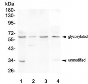Western blot testing of human 1) HEK293, 2) Jurkat, 3) CCRF-CEM and 4) mouse thymus lysate with CD272 antibody at 0.5ug/ml. Predicted molecular weight: 33-60 kDa depending on level of glycosylation.