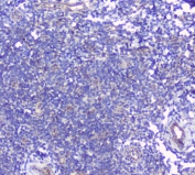 IHC staining of FFPE human tonsil tissue with CD272 antibody at 1ug/ml. HIER: boil tissue sections in pH6, 10mM citrate buffer, for 10-20 min and allow to cool before testing.