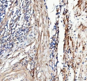 IHC staining of FFPE human tonsil tissue with COL3A1 antibody. HIER: boil tissue sections in pH8 EDTA for 20 min and allow to cool before testing.