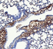 IHC staining of FFPE mouse lung tissue with COL3A1 antibody. HIER: boil tissue sections in pH8 EDTA for 20 min and allow to cool before testing.