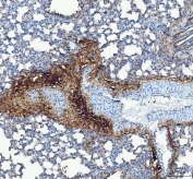IHC staining of FFPE rat lung tissue with COL3A1 antibody. HIER: boil tissue sections in pH8 EDTA for 20 min and allow to cool before testing.