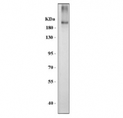 Western blot testing of mouse skin tissue lysate with COL3A1 antibody at 0.5ug/ml. Predicted molecular weight ~139 kDa but may be observed at higher molecular weights due to glycosylation.