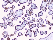 IHC staining of FFPE human placenta with CYP19A1 antibody. HIER: boil tissue sections in pH6, 10mM citrate buffer, for 10-20 min and allow to cool before testing.