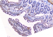 IHC staining of FFPE rat small intestine with CYP19A1 antibody. HIER: boil tissue sections in pH6, 10mM citrate buffer, for 10-20 min and allow to cool before testing.