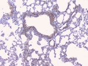 IHC staining of FFPE rat lung with CYP19A1 antibody. HIER: boil tissue sections in pH6, 10mM citrate buffer, for 10-20 min and allow to cool before testing.