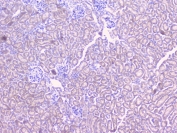 IHC staining of FFPE mouse kidney with DIS3 antibody at 1ug/ml. HIER: boil tissue sections in pH6, 10mM citrate buffer, for 10-20 min and allow to cool before testing.