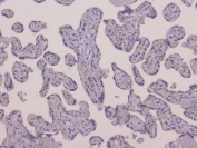 IHC staining of FFPE human placenta with DIS3 antibody at 1ug/ml. HIER: boil tissue sections in pH6, 10mM citrate buffer, for 10-20 min and allow to cool before testing.