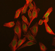 IHC staining of FFPE human placenta with DIS3 antibody at 1ug/ml. HIER: boil tissue sections in pH6, 10mM citrate buffer, for 10-20 min and allow to cool before testing.