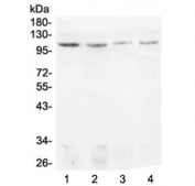 Western blot testing of human 1) HeLa, 2) HEK293, 3) MDA-MB-231 and 4) Caco-2 lysate with DIS3 antibody at 0.5ug/ml. Predicted molecular weight ~109 kDa.