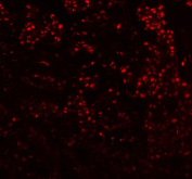 Western blot testing of human 1) HeLa, 2) HEK293, 3) MDA-MB-231 and 4) Caco-2 lysate with DIS3 antibody at 0.5ug/ml. Predicted molecular weight ~109 kDa.