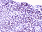 IHC staining of FFPE rat kidney with DIS3 antibody at 1ug/ml. HIER: boil tissue sections in pH6, 10mM citrate buffer, for 10-20 min and allow to cool before testing.