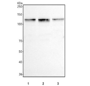 IHC staining of FFPE rat kidney with DIS3 antibody at 1ug/ml. HIER: boil tissue sections in pH6, 10mM citrate buffer, for 10-20 min and allow to cool before testing.