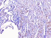 IHC staining of FFPE rat kidney with DIS3 antibody at 1ug/ml. HIER: boil tissue sections in pH6, 10mM citrate buffer, for 10-20 min and allow to cool before testing.