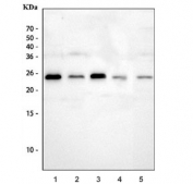 Western blot testing of 1) human MCF7, 2) human HL-60, 3) human HeLa, 4) rat testis and 5) mouse testis tissue lysate with Grancalcin antibody at 0.5ug/ml. Predicted molecular weight ~24 kDa.