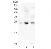 Western blot testing of human 1) placenta, 2) HL-60 and 3) Caco-2 lysate with Grancalcin antibody at 0.5ug/ml. Predicted molecular weight ~24 kDa.