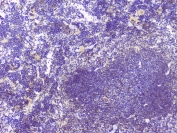 IHC staining of FFPE mouse spleen with HAS1 antibody at 1ug/ml. HIER: boil tissue sections in pH6, 10mM citrate buffer, for 10-20 min and allow to cool before testing.