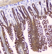 IHC staining of FFPE rat small intestine with HAS1 antibody at 1ug/ml. HIER: boil tissue sections in pH6, 10mM citrate buffer, for 10-20 min and allow to cool before testing.